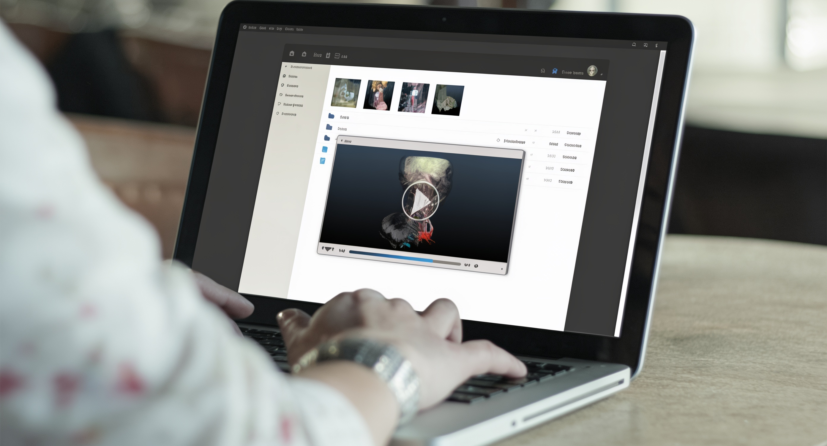 WebSeg – webbasierte Segmentierungsplattform für patientenindividuelle 3D-Modelle